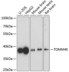 Western blot analysis of extracts of various cell lines, using Anti-TOMM40 Antibody (A9160) at 1:1000 dilution