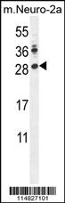 Anti-LIN28 Rabbit Polyclonal Antibody [clone: 8H10D10]