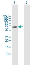 Anti-GART Rabbit Polyclonal Antibody