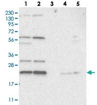 Anti-MED28 Rabbit Polyclonal Antibody