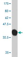 Anti-PCDHGB2 Mouse Monoclonal Antibody [clone: 6E9]