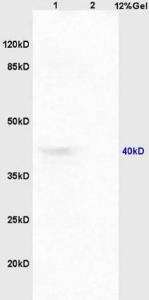 Anti-CCR9 Rabbit Polyclonal Antibody