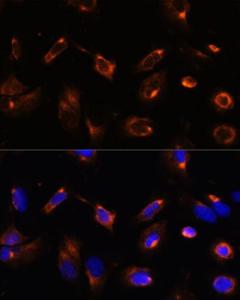 Anti-LRRFIP2 antibody