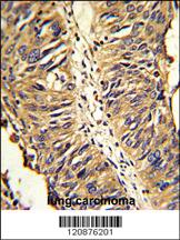 Anti-PDIA3 Rabbit Polyclonal Antibody