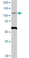 Anti-GART Rabbit Polyclonal Antibody