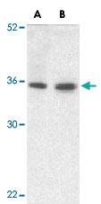 Anti-TRIM5 Rabbit Polyclonal Antibody