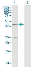 Anti-EV71 VP1 Rabbit Polyclonal Antibody