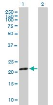 Anti-SYT16 Mouse Polyclonal Antibody