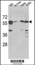 Anti-SPTLC1 Rabbit Polyclonal Antibody (FITC (Fluorescein))