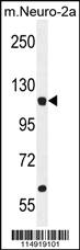 Anti-LARS Rabbit Polyclonal Antibody [clone: 87CT59.3.7]