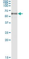 Anti-SNX1 Polyclonal Antibody Pair