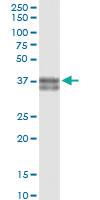 Anti-PXN Rabbit Polyclonal Antibody