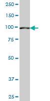 Anti-SETDB2 Mouse Monoclonal Antibody [clone: 1E2]