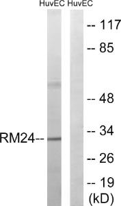 Western blot analysis of lysates from HUVEC cells using Anti-MRPL24 Antibody. The right hand lane represents a negative control, where the Antibody is blocked by the immunising peptide