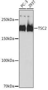 Western blot analysis of extracts of various cell lines, using Anti-Tuberin Antibody [ARC0019] (A305347) at 1:1,000 dilution The secondary antibody was Goat Anti-Rabbit IgG H&L Antibody (HRP) at 1:10,000 dilution Lysates/proteins were present at 25 µg per lane