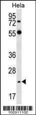 Anti-NEUROG2 Rabbit Polyclonal Antibody (HRP (Horseradish Peroxidase))