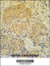 Anti-IPO7 Rabbit Polyclonal Antibody