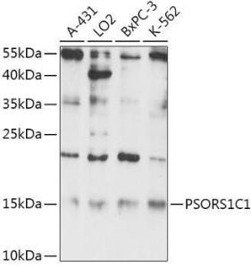 Western blot analysis of extracts of various cell lines, using Anti-PSORS1C1 Antibody (A306250) at 1:1,000 dilution