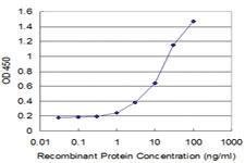 Anti-CRLF1 Mouse Monoclonal Antibody [clone: 5C2]