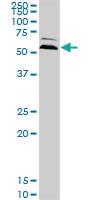 Anti-UBQLN2 Mouse Monoclonal Antibody [clone: 5F5]