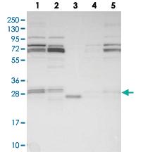 Anti-SPAG7 Rabbit Polyclonal Antibody