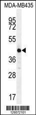 Anti-ALX4 Rabbit Polyclonal Antibody (FITC (Fluorescein Isothiocyanate))