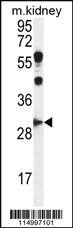 Anti-CCNG1 Rabbit Polyclonal Antibody [clone: 17CT9.2.8]