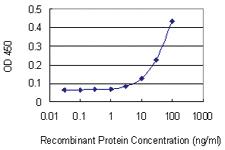 Anti-SETDB2 Mouse Monoclonal Antibody [clone: 1E2]