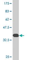 Anti-RNF111 Mouse Monoclonal Antibody [clone: 1C4]