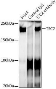 Immunoprecipitation analysis of 300 µg extracts of 293T cells using 3 µg of Anti-Tuberin Antibody [ARC0019] (A305347) This Western blot was performed on the immunoprecipitate using Anti-Tuberin Antibody [ARC0019] (A305347) at a dilution of 1:1000