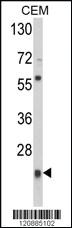 Anti-KBTBD13 Rabbit Polyclonal Antibody