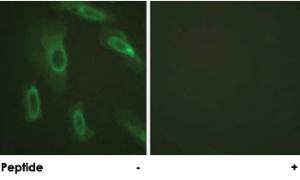 Anti-MUC1 Rabbit Polyclonal Antibody