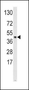 Anti-SKP2 Rabbit Polyclonal Antibody