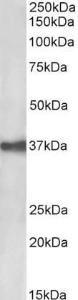 Anti-EPCAM Antibody (A85204) (0.03µg/ml) staining of CACO-2 lysate (35µg protein in RIPA buffer). Primary incubation was 1 hour. Detected by chemiluminescence.