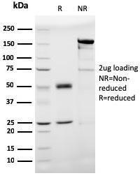 SDS-PAGE analysis of Anti-Prohibitin Antibody [PHB/3193] under non-reduced and reduced conditions; showing intact IgG and intact heavy and light chains, respectively. SDS-PAGE analysis confirms the integrity and purity of the antibody.