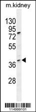 Anti-CCNH Rabbit Polyclonal Antibody [clone: 33CT11.40.3]