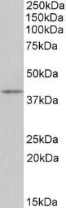 Anti-Cd28 Antibody (A83543) (0.3 µg/ml) staining of Mouse Thymus lysate (35 µg protein in RIPA buffer). Primary incubation was 1 hour. Detected by chemiluminescence