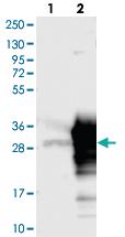 Anti-SPAG7 Rabbit Polyclonal Antibody