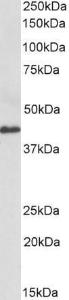 Anti-CX3CL1 Antibody (A85205) (0.3 µg/ml) staining of Human Colorectal cancer lysate (35 µg protein in RIPA buffer). Primary incubation was 1 hour. Detected by chemilu minescence