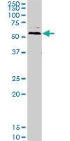 Anti-UBQLN2 Mouse Monoclonal Antibody [clone: 5F5]