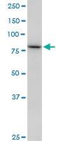 Anti-SETDB2 Mouse Monoclonal Antibody [clone: 2F4]