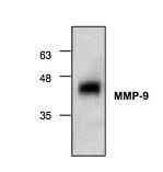 Anti-MMP9 Rabbit Polyclonal Antibody