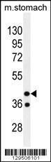 Anti-GIN1 Rabbit Polyclonal Antibody (Biotin)