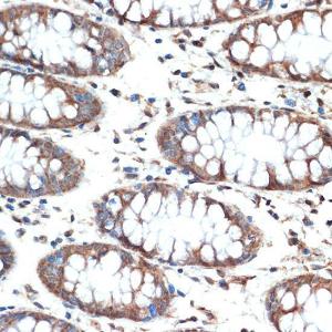 Immunohistochemistry analysis of paraffin-embedded human colon tissue using Anti-MUC4 Antibody [ARC1999] (A309154) at a dilution of 1:100 (40X lens). Perform microwave antigen retrieval with 10 mM Tris/EDTA buffer pH 9.0 before commencing with IHC staining protocol