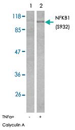 Anti-NFKB1 Rabbit Polyclonal Antibody