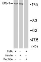 Anti-IRS1 Rabbit Polyclonal Antibody