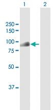 Anti-DTL Rabbit Polyclonal Antibody