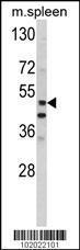 Anti-MMP10 Rabbit Polyclonal Antibody (AP (Alkaline Phosphatase))