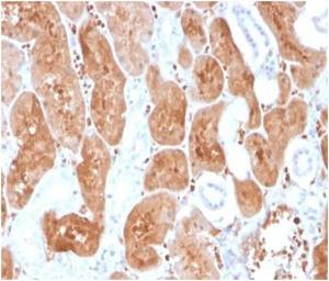 Immunohistochemical analysis of formalin-fixed, paraffin-embedded human adrenal gland tissue using Anti-IL-2 Antibody [IL2/3950]