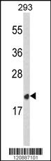 Anti-PRDX2 Rabbit Polyclonal Antibody